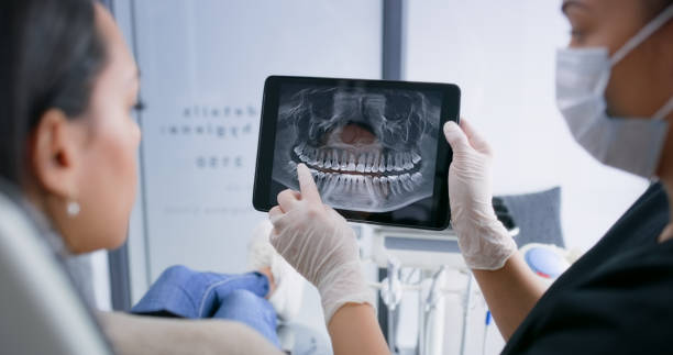 Licensed Tooth Extraction service in Bartow County County, GA - Smile Center Dentistry